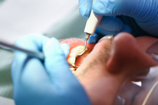Best Emergency Gum Treatment in Floresville, TX