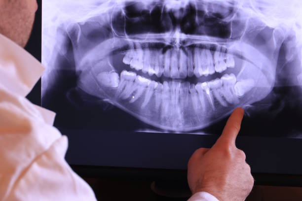 Best Emergency TMJ Treatment in Floresville, TX
