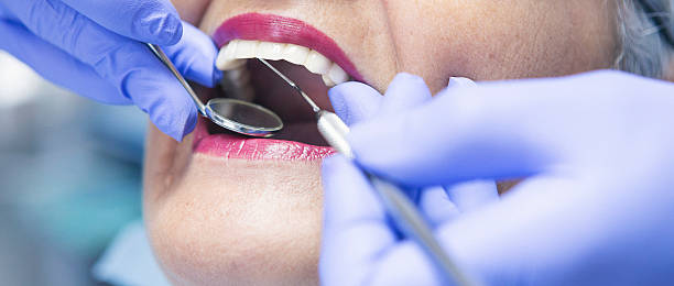 Best Emergency Dental Care for Broken or Chipped Teeth in Floresville, TX