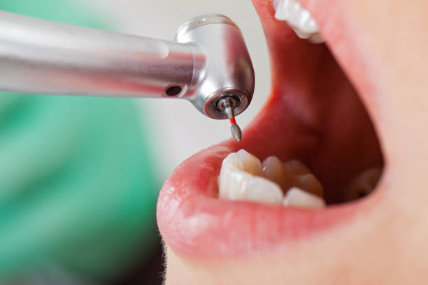 Best Same-Day Emergency Dental Services in Floresville, TX